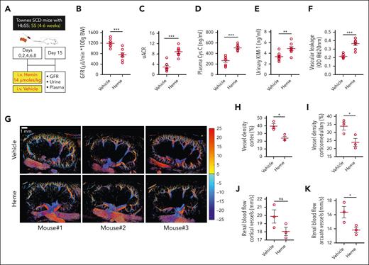 CKD development in sickle mice after repeated hemolytic events. (A) Experimental scheme showing the regimen of repeated low-dose hemin injections, mimicking multiple hemolytic events in SS mice. (B) Kidney function represented by GFR, 1 week after the last hemin challenge in the younger SS mice (4-6 weeks) compared with the vehicle-injected mice (n = 8; M, 4; F, 4). (C-E) Increased albuminuria (represented by uACR), plasma Cys C, and urinary KIM-1 in multiheme-challenged SS mice showing CKD development in younger SS mice. (F) Evans blue extravasation data showing elevated renal endothelial barrier disruption in younger SS mice injected with the multiheme regimen (n = 5-6; M, 2-3; F, 3). (G) Vehicle- and heme-injected SS mice were subjected to SRU imaging 1 week after the last hemin challenge. The reconstructed 2-dimensional, cross-sectional, SRU images of the long-axis mouse kidney showing vessel distribution and the velocity map for the vehicle and hemin-challenged mice (n = 3; M, 2; F, 1). The velocity values were separated into positive (displayed as red in the color map) and negative values (displayed as blue in the color map), representing the blood flow direction toward and away from the US probe to separate the arteries and veins, respectively. Quantitation of (H-I) vessel densities and (J-K) renal blood flow calculated from the SRU data showing loss of vessels and reduced blood flow in the SS mouse kidney after multiheme-induced CKD development. ∗P < .05; ∗∗∗P < .001 (unpaired Student t test).