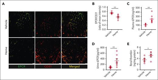 Alterations in the renal microvascular EPCR distribution in SS mice after multiheme-induced CKD. (A) Representative images from immunofluorescence staining indicating a lack of EPCR in the renal endothelium marked with CD31-positive staining. (B) Quantitation of staining intensity (EPCR/CD31 ratio), indicating significant deterioration of renal endothelial EPCR in heme-challenged mice (n = 6; M, 3; F, 3). (C-D) Higher concentrations of EPCR in the plasma (C) and urine (D) detected in the heme-challenged SS mice compared with those challenged with vehicle (n = 8; M, 4; F, 4). (E) Quantitation of thrombin accumulation in SS mouse kidneys after a multiheme challenge (n = 6; M, 3; F, 3). ∗P < .05; ∗∗P < .01 (unpaired Student t test).