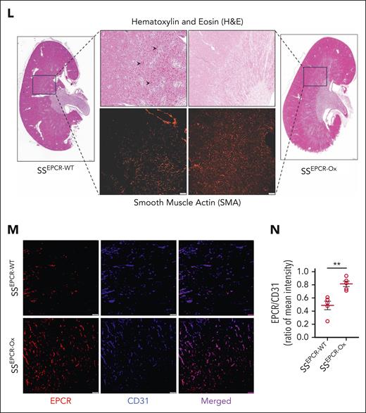 Preservation of renal health after heme-induced CKD in SCD mice with EPCR overexpression. (A-D) EPCR-WT and EPCR-Ox mice underwent transplantation with SS bone marrow to create sickle chimera mice with normal (SSEPCR-WT) and overexpression (SSEPCR-Ox) of EPCR on the vascular endothelium. The mice were then subjected to a multiheme challenge. GFR was measured, and plasma and urine samples were collected at baseline (BL) and 7 days after the last heme injection (H). Worsening renal function showing (A) reduced GFR and increased (B) uACR, (C) plasma Cys C, and (D) urinary KIM-1 in SSEPCR-WT compared with SSEPCR-Ox mice (n = 5-7; M, 2-3; F, 3-4). (E) Plasma sEPCR at BL and after the multiheme challenge in SSEPCR-WT and SSEPCR-Ox mice (n = 6; M, 3; F, 3). (F) Total thrombin in the kidney tissues harvested from SSEPCR-WT and SSEPCR-Ox mice (n = 5-6; M, 2-3; F, 3). (G) Representative restructured SRU images showing the scarcity of renal vasculature in SSEPCR-WT mice (n = 3; M, 1; F, 2). (H-I) Quantitation of vessel density in SSEPCR-WT and SSEPCR-Ox mice (n = 3). (J-K) Calculated renal blood flow in the indicated sickle bone marrow chimera mice after multiheme challenge (n = 3). (L) Representative stitched images (scale bar = 500 μm) of the whole kidney from the multiheme-challenged SSEPCR-WT and SSEPCR-Ox mice. The indicated areas are digitally enlarged to show corticomedullary congestion (arrowhead). Serial tissue sections stained for smooth muscle actin showing microvessel distribution in the indicated area (scale bar = 100 μm). (M-N) Representative immunofluorescence images (scale bar = 50 μm) and quantitation of the EPCR/CD31 intensity ratio in renal tissue sections from SSEPCR-WT and SSEPCR-Ox mice (n = 3) after heme challenge. ∗P < .05; ∗∗P < .001 (paired and unpaired Student t test).