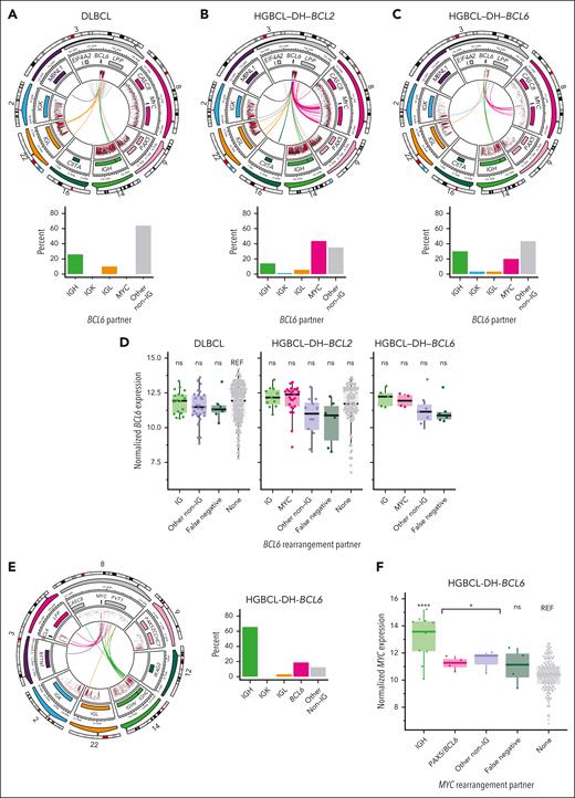 BCL6-R architecture. (A-C) Diagrams showing the architecture of MYC::IGH rearrangements at high resolution (top row) and the frequency of each rearrangement partner (bottom row) across DLBCL (A), HGBCL-DH-BCL2 (B), and HGBCL-DH-BCL6 (C). In each circular plot, the outermost ring gives the chromosome ideogram, followed by a genomic coordinate scale, a gene coordinate track, and a rainfall plot of intermutation distance with points colored according to whether the mutation overlaps the canonical AID WRCY motif (red) or not (black). Innermost lines show the linkages between BCL6 and IGH. (D) BCL6 expression measured from RNAseq data, stratified by lymphoma entity and BCL6-R partner. FDR-corrected Wilcoxon tests compared the expression of BCL6 stratified by rearrangement partner with that of DLBCL without BCL6-R. (E) Diagram showing MYC-R architecture in HGBCL-DH-BCL6. (F) MYC expression determined in HGBCL-DH-BCL6. FDR-corrected Wilcoxon tests compared the expression of MYC::IGH, all MYC::non-IGH, or false negative (tumors in which the MYC partner was not identified by sequencing) with the expression of MYC in DLBCL without MYC-R (“none”). ns, not significant; ∗P < .05; ∗∗∗∗P < .0001.