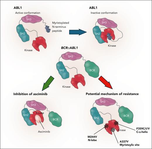 Mechanism of action of asciminib and specific mutations responsible for resistance. A337V situated on myristoylic site M244V on the N lobe and F359C/I/V on the alpha helix.