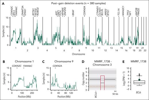 Postgain deletion prevalence and functional impact in patients with newly diagnosed and relapsed RM. (A) Cumulative distribution plot of 382 MM samples with postgain deletions. Top of the plot shows TSGs and oncogenes that were enriched with more than the median number of patients per 1 Mb bin having a postgain deletion on the given chromosome. (B) Enlarged distribution of postgain deletions per 1 Mb bin on chromosome 1 with involvement of the TSGs CDKN2C and FAM46C. (C) Enlarged distribution of postgain deletions per 1 Mb bin on chromosome 9 with involvement of the TSG CDKN2A. (D) CNV plot showing a postgain deletion near BCL6 in NDMM patient MMRF_1738. (E) RNAseq transcript levels of NDMM patients from the MMRF study with patient MMRF_1738 highlighted in green, showing overexpression.