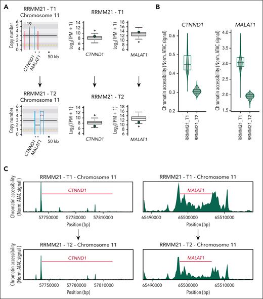 Single-cell ATACseq data from patients with RRMM reveal a novel mechanism of tumor suppressor inactivation. (A) Patient RRMM21 showed postgain deletion selected between 2 distinct time points (T1, the earliest; T2, the latest), which led to downregulation of 2 tumor suppressors, namely CTNND1 and MALAT1 (ie, loss of function). (B-C) Single-cell ATAC sequencing showed loss of chromatin accessibility after the postgain deletion near both genes between the 2 samples.
