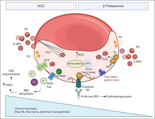 Effects of free iron on red cells from patients with either β-thalassemia or SCD. In pathologic red cells free iron sustains chronic oxidation with generation of reactive oxygen species (ROS) throughout the Fenton reaction. This requires an efficient antioxidant machinery with the metabolic support of ATP (see also Figure 3). The chronic and severe red cell membrane damage is further amplified respectively by membrane association of free alpha chains in β-thalassemic erythrocytes and cyclic polymerization/depolymerization events in sickle red cells. In both disorders, red cell membrane oxidation results in (1) increased membrane mechanical instability favoring to abnormally clusterization of oxidized band 3 (B3); (2) exposition of phosphatidyl serine (PS); and (3) generation of erythroid microparticles (E-MP), also carrying PS. The cumulative effects of oxidation are the premature red cell aging with accelerated removal by erythrophagocytosis mediated by both PS exposure and naturally occurring anti–band 3 antibody (N-Ab). In addition, in sickle erythrocytes, membrane damage is associated with increase permeability to Ca2+ with the activation of the Gardos channel (KCNN4) coupled with the oxidation induced activation of the K-Cl (KCC) cotransport. This ends in sickle red cell dehydration, relative increase in HbS concentration with a negative impact on HbS polymerization kinetic. Of note, in SCD a smaller component of hemolysis takes place intravascularly with saturation of physiologic binding proteins (eg, hemopexin) allowing for the presence of free heme and Hb in the peripheral circulation.