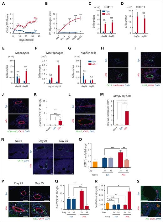 Hepatic GVHD induces apoptosis and transitory proliferation of BECs. (A-G) Lethally irradiated BDF1 mice were transplanted from allogeneic B6 (Allo) or syngeneic BDF1 (Syn) donors on day 0. Clinical GVHD scores (A; n = 11-12/group) and pathologic liver GVHD scores (B; n = 10/group) are shown. (C-G) Flow cytometric analyses of liver mononuclear cells were performed at indicated time points (n = 7-12/group). See also supplemental Figures 1 and 2. Absolute numbers of donor CD4+ T cells (C), CD8+ T cells (D), donor monocytes (E), infiltrating donor macrophages (F), and Kupffer cells (G) are shown. (H,I) Lethally irradiated B6 (Syn) or BDF1 (Allo) mice were transplanted with purified T cells from B6 Lck-cre×R26Tomato combined with B6 T-cell-depleted-BM cells on day 0. (H) Immunofluorescent staining of CK19 (green), tdTomato+ donor T cells (red) with DAPI (4′,6-diamidino-2-phenylindole; blue) staining on day 21 after HCT. (I) Immunofluorescent staining of CK19 (green), F4/80 (red) with DAPI (blue) staining on day 28 after HCT. (J-S) Lethally irradiated BDF1 mice were transplanted as in Figure 1A. Immunofluorescent staining of cleaved caspase-3 (cCaspase3; green) and CK19 (red) with DAPI (blue) staining on day 21 after HCT. Representative images (J) and the proportion (K) of cCaspase 3+ BECs (n = 4-5/group). (L) Immunofluorescent staining of Mmp7 (green) and CK19 (red) with DAPI (blue) staining on day 21. (M) Relative expression of Mmp7 in the liver on day 21 (n = 5/group). (N,O) Immunofluorescent staining of CK19 (green) with DAPI (blue) staining on days 21 and 35. Representative images (N) and proportion (O) of CK19+ area were shown as fold change from naive mice (n = 5/group). (P,Q) Immunofluorescent staining of Ki-67 (green) and CK19 (red) with DAPI (blue) staining on days 21 and 35. Representative images (P) and proportions (Q) of Ki-67+ cells among CK19+ BECs were shown (n = 5/group). White arrows indicate clusters of Ki-67+ BECs. (R) Plasma levels of total bilirubin from the recipients (n = 10/group) and naïve BDF1 (n = 4) were shown. (S) Immunofluorescent staining of albumin (Alb; green) and CK19 (red) with DAPI (blue) staining 70 days after HCT. (A-G, O, Q, R) Data from 2 independent experiments were combined and shown as mean ± standard error (SE). (K,M) Data from 1 of 2 independent experiments are shown as mean ± SE. Bar, 100 μm. ∗P < .05, ∗∗P < .01, ∗∗∗P < .005.