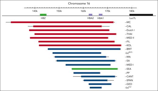 Deletions of 2 α-genes giving rise to α0-thalassemia. Deletions that involve the ζ-globin gene (HBZ) are depicted in red. By far the most common α0-thalassemia deletion involved in Hb Bart’s hydrops fetalis (−−SEA deletion) is depicted in green. Bold lines indicate sequences known to be deleted. Thin lines indicate regions of uncertainty around the breakpoints. Reproduced with permission, with minor modifications, from Harteveld and Higgs.9