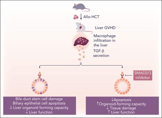 BDSCs are direct targets of GVHD in a TGF-β-dependent manner. Allo-HCT in mice induces macrophage infiltration into the liver as GVHD develops. Macrophages secrete TGF-β, which induces apoptosis of biliary epithelial cells and reduces the organoid-forming and regenerative capacity of bile duct stem cells. Bile duct stem cell loss results in histological liver damage and reduced liver function. Inhibition of canonical TGF-β signaling with a SMAD2/3 inhibitor preserves bile duct stem cells, restores their organoid-forming capacity, and reduces liver dysfunction. Professional illustration by Somersault18:24.