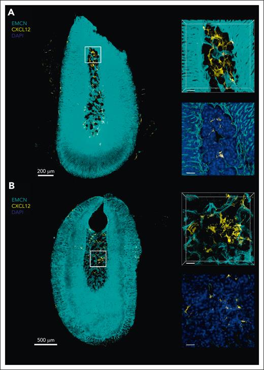 The murine adrenal gland contains CXCL12+ cells with reticular morphology 3-dimensional (3D) microscopy of murine adrenal glands. Representative 3D sections and optical slices of immunostained adrenal glands from control-treated (A; n = 3) and EMH-induced (B; n = 3) Cxcl12GFP transgenic mice showing endomucin (EMCN; cyan), CXCL12-GFP (yellow), and 4’,6-diamidino-2-phenylindole (DAPI; blue). Scale bars represent 200 μm (A) and 500 μm (B) in the left images, and 40 μm for enlarged sections and optical slices on the right.