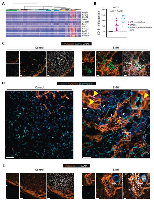 EMH-induced adrenal glands have a modified stromal architecture with PDGFRα clusters hosting hematopoietic foci with rare c-Kit+ HSPCs. (A) Selection of genes enriched in the PDGFRα-expressing cells of the murine adrenal gland (PDGFRα-expressing clusters: mC6 “mesenchymal” in red and mC13 “capsule” in purple, as defined by Bedoya-Reina et al19). (B) Adrenal plastic-adherent cells are supportive of CD45+ cell expansion. Expansion of total hematopoietic cells (CD45+) upon coculture for 7 days of fluorescence-activated cell sorted murine HSPCs (LKS) with a confluent feeder layer of BM stromal cells (BMSCs) obtained from flushed, collagenase-digested bones or adrenal gland, in the absence of additional cytokines. Data are represented as mean ± SD and groups were compared with 1-way ANOVA followed by Holms-Šidák multiple correction test (n = 5 for LKS monoculture, 6 for BMSCs, and 11 for adrenal plastic-adherent cells. Data were obtained in 2 independent experiments). (C) Representative images of control and EMH–induced adrenal glands (n = 2-3 mice per group) stained for CD45 (green), PDGFRα (orange) and DAPI (white). Scale bars represent 20 μm in all instances in panel C. (D) Representative images of control and EMH-induced adrenal glands (n = 2, multiple nodules per adrenal) stained for LEPR (blue), PDGFRα (orange), and endomucin (teal). Yellow arrowheads indicate examples of colocalization of PDGFRα and LEPR (colocalization in pink), with the latter having an elongated pattern marking cells in pericyte position, whereas white arrowheads indicate adrenal parenchyma cells that display a different pattern of LEPR, mostly perinuclear. Scale bars represent 20 μm in all instances in panel D, except for the inset, in which it represents 5 μm. (E) Representative images of control and EMH-induced adrenal glands (n = 3, multiple nodules per adrenal) stained for PDGFRα (orange), cKit (blue), and DAPI (white). Scale bars represent 20 μm in the controls, and 10 μm in the EMH-induced mice. The scale bar in the inset represents 5 μm.