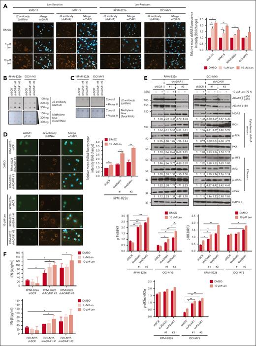 ADAR1-mediated RNA editing inhibits lenalidomide-induced dsRNA-sensing responses in MM cells. (A) Immunofluorescence analysis of cellular dsRNA with J2 antibody in Len-sensitive (KMS-11 and MM1.S cells) vs Len-resistant (RPMI-8226 cells and OCI-MY5) cells after treatment with lenalidomide (1 or 10 μM) for 72 hours (left). Orange-red fluorescence indicates dsRNA signals and blue fluorescence indicates DAPI (4′,6-diamidino-2-phenylindole) staining. Scale bars indicate 20 μm. Bar graph quantification of the relative mean cytoplasmic dsRNA fluorescence intensity (right). (B) Dot blot analysis of cellular dsRNA using dsRNA-specific J2 antibody in total RNA extracted from ADAR1-KD RPMI-8226 and OCI-MY5 cells blotted on Biodyne nylon membrane. RNA loading was verified by methylene blue staining. (C) Dot blot analysis of cellular dsRNA using dsRNA-specific J2 antibody in total RNA extracted from ADAR1-KD RPMI-8226 and OCI-MY5 cells blotted on Biodyne nylon membrane. As indicated, total RNA extracted were treated with RNase III for 30 minutes at 37°C as negative control for dsRNA signal. RNA loading was verified by methylene blue staining. (D) Immunofluorescence analysis of cellular dsRNA with J2 antibody in ADAR1-KD RPMI-8226 cells after treatment with lenalidomide (10 μM) for 72 hours (left). Orange-red fluorescence indicates dsRNA signals, green fluorescence indicates ADAR1 p150 expression, and blue fluorescence indicates DAPI staining. Scale bars indicate 20 μm. Bar graph quantification of the relative mean cytoplasmic dsRNA fluorescence intensity (right). (E) Western blot analysis of whole-cell lysates for total ADAR1 (ab88574; Abcam), ADAR1 p150 (ab126745; Abcam), and the dsRNA sensor–mediated signaling in ADAR1-KD RPMI-8226 and OCI-MY5 cells after treatment with lenalidomide (10 μM) for 72 hours (top). The bar graphs (bottom) summarize p-PKR, p-IRF3, and p-eIF2α band intensities normalized to GAPDH and total protein content, quantified via ImageJ. Densitometry analyses for the relative protein expression normalized to GAPDH are displayed below the western blots. (F) Induction of IFN-β protein secretion by ADAR1-KD RPMI-8226 and OCI-MY5 cells after treatment with lenalidomide (1 or 10 μM) for 72 hours, assessed by ELISA. Data are presented as mean ± SD of biological triplicates. Statistical significance is denoted by ∗P ≤ 0.05; ∗∗P ≤ 0.01; ∗∗∗P ≤ 0.001, as determined by two-tailed Student t test.