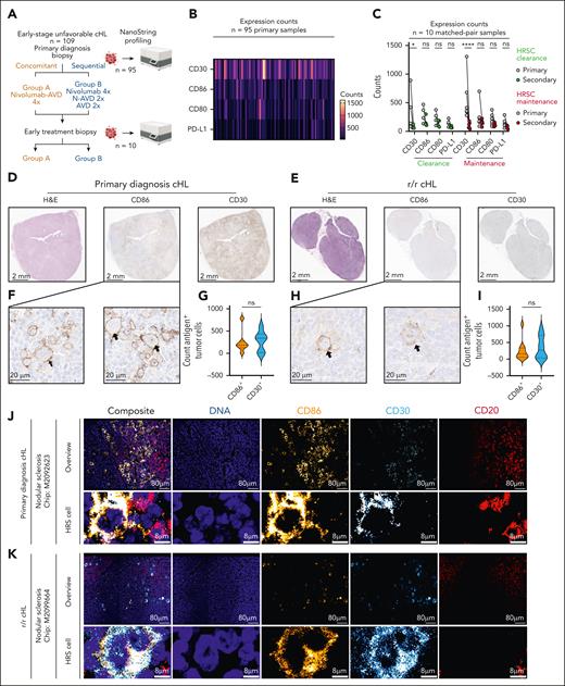 CD86 is highly expressed in primary diagnosis and R/R cHL. (A) Summary of treatment schedules and cohort distribution of the NIVHAL trial.52 (B) Heat map illustrating expression of reference control gene CD30 or candidate antigens CD86, CD80, and PD-L1 in the NIVHAL cohort (n = 95 primary diagnosis samples). Each line represents 1 patient. (C) Change of target antigen expression between primary (gray) and secondary (light green, red) biopsies after NIVHAL trial first-line therapy. Treatment response was evaluated by a board-certified pathologist and classified into HRSC clearance (light green, n = 4 primary patient samples) or HRSC maintenance (red, n = 6 primary patient samples). Statistical significance was calculated using 2-way ANOVA with Sidak multiple comparison correction. (D-E) H&E (left) or immunohistochemical staining of CD86 (middle) in comparison to CD30 (right) in primary cHL tissue. (D,F,G) Primary diagnosis cHL samples. n = 7 different patients. (E,H-I) R/R cHL samples. n = 10 different patients. (F,H) Representative images of CD86+ HRSCs. Arrowheads indicate HRSCs. (G,I) Count of CD86+ or CD30+ HRSCs in primary diagnosis cHL samples (G) or R/R cHL (I) quantified by machine learning classifier. Statistical significance was calculated using unpaired t test. (J-K) Expression of CD86 on HRSCs measured by multiplex immunofluorescence microscopy on chip-loaded primary diagnosis cHL samples (J) or R/R cHL (K). Chips were sequentially stained with antibodies against CD86 (yellow), CD30 (blue), and CD20 (red) and with a DNA Hoechst stain (blue). Between each staining step, images were acquired with a fluorescence microscope followed by a 30-second photobleaching procedure. For all panels: ∗P < .05; ∗∗P < .01; ∗∗∗P < .001; ∗∗∗∗P < .0001. ns, P > .05.