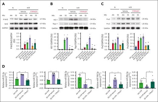 17R-RvD1 prevents H/R-induced activation of Nfr2 system and modulates miRNA related to proinflammatory and profibrotic pathways in the hearts of sickle cell mice. (A) Immunoblot analysis using specific antibodies against p-Nrf2 and Nrf2 in the hearts of AA and SS mice under normoxia and treated with vehicle or 17R-RvD1 (100 ng) and exposed to H/R: hypoxia (8% oxygen; 10 hours), followed by reoxygenation (21% oxygen; 3 hours); 75 μg/μL of protein loaded on an 8% T, 2.5% C polyacrylamide gel. One representative gel from 4 gels with similar results is shown. Densitometric analysis of immunoblots is shown on the right. Data are presented as means ± SEM (n = 4). ∗P < .05 (compared with normoxia); §P < .05 (compared with AA normoxia); °P < .05 (compared with vehicle-treated mice). (B) Immunoblot analysis using specific antibodies against HO-1 and Nqo1 in the hearts of AA and SS mice treated, similar to panel A; 75 μg/μL of protein loaded on an 11% T, 2.5% C polyacrylamide gel. Glyceraldehyde 3-phosphate dehydrogenase (GAPDH) serves as protein loading control. One representative gel from 4 with similar results is shown. Densitometric analysis of immunoblots is shown (right). Data are presented as means ± SEM (n = 4). ∗P < .05 (compared with normoxia); °P < .05 (compared with vehicle-treated mice by 1-way ANOVA). (C) Immunoblot analysis, using specific antibodies against Prx2 and Prx3, in the hearts of AA and SS mice treated similar to panel A; 30 μg/μL of protein loaded on an 11% T, 2.5% C polyacrylamide gel. GAPDH serves as protein loading control. One representative gel from 4 with similar results is shown. Densitometric analysis of immunoblots is shown (right). Data are presented as means ± SEM (n = 4). ∗P < .05 (compared with normoxia); §P < .05 (compared with AA normoxia); °P < .05 (compared with vehicle-treated mice by 1-way ANOVA). (D) miRNAs regulated by 17R-RvD1 in the hearts of SS mice undergoing H/R. MicroRNA expression was determined using RNU5G, RNU1A1, and SNORD61 as housekeeping small noncoding RNAs. ∗P < .05; ∗∗P < .01 (1-way ANOVA). Wb, Western blot.