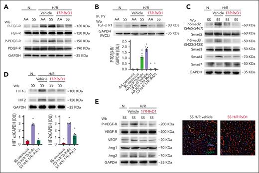 17R-RvD1 protects against the H/R activation of profibrotic pathways in sickle cell mice. (A) Immunoblot analysis using specific antibodies against p-FGF-R, FGF-R, p-PDGF-R, and PDGF-R in the hearts of AA and SS mice under normoxia, treated with vehicle or 17R-RvD1 (100 ng), and exposed to H/R: hypoxia (8% oxygen; 10 hours), followed by reoxygenation (21% oxygen; 3 hours). One representative gel from 4 gels with similar results is shown; 75 μg/μL of protein loaded on an 11% T, 2.5% C polyacrylamide gel. Glyceraldehyde 3-phosphate dehydrogenase (GAPDH) serves as protein loading control. Densitometric analysis immunoblots are shown in supplemental Figure 12A. (B) IP of the hearts of AA and SS mice, treated similar to panel A, using specific IP: PY, revealed with specific anti–TGF-β Rec antibody (75 μg/μL of protein loaded on an 8% T, 2.5% C polyacrylamide gel). GAPDH in WCL is used as loading controls. One representative gel from 4 others with similar results is presented. Densitometric analysis of immunoblots is shown (lower panel). Data are presented as means ± SEM (n = 4). ∗P < .05 (compared with normoxia); °P < .05 (compared with vehicle-treated mice by 1-way ANOVA). (C) Immunoblot analysis using specific antibodies against phosphorylated Smad2 (p-Smad2), Smad2, p-Smad3, Smad3, Smad4, and Smad7 in the hearts of AA and SS mice under normoxia, treated with vehicle or 17R-RvD1 (100 ng), and exposed to H/R: hypoxia (8% oxygen; 10 hours), followed by reoxygenation (21% oxygen; 3 hours). One representative gel from 4 gels with similar results is shown. A total of 75 μg/μL of protein loaded on an 11% T, 2.5% C polyacrylamide gel. GAPDH serves as protein loading control. Densitometric analysis immunoblots are shown in supplemental Figure 12C. (D) Immunoblot analysis using specific antibodies against HIF1α and HIF2 in the hearts of AA and SS mice treated similar to panel C. One representative gel from 4 gels with similar results is shown; 50 μg/μL of protein loaded on an 8% T, 2.5% C polyacrylamide gel. GAPDH serves as protein loading control. Densitometric analysis of immunoblots is shown in the lower panel. Data are presented as means ± SEM (n = 4). ∗P < .05 (compared with normoxia); °P < .05 (compared with vehicle-treated mice by 1-way ANOVA). (E) Immunoblot analysis (left) using specific antibodies against phosphorylated VEGF receptor (p-VEGF-R), VEGF-R, angiopoietin-1 (Ang 1), and Ang 2 in the hearts of AA and SS mice treated similar to panel C. One representative gel from 4 gels with similar results is shown; 75 μg/μL of protein loaded on a 10% T, 2.5% C polyacrylamide gel. GAPDH serves as protein loading control. Densitometric analysis of immunoblots is shown in supplemental Figure 13A. Data are presented as means ± SEM (n = 4). ∗P < .05 (compared with normoxia). °P < .05 (compared with vehicle-treated mice by 1-way ANOVA). Representative merged immunofluorescence staining of VEG-FR on small and large CD31+ vascular endothelial cells in the hearts of SS mice undergoing H/R and treated with vehicle or 17R-RvD1 (right). Arrow denotes a large blood vessel staining positive for VEGF-R. Nuclei were stained with DAPI. Separate staining is shown in supplemental Figure 13B. Wb, Western blot.