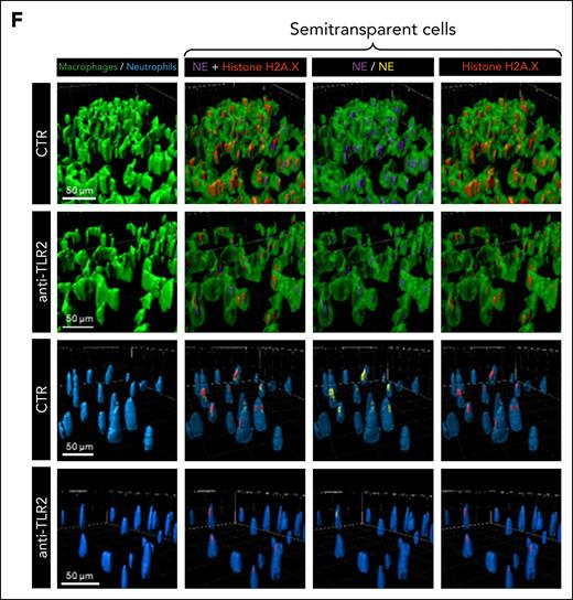 Receptors involved in engulfment of NET proteins by macrophages and neutrophils present in the liver. Mice were imaged 24 hours after the induction of endotoxemia (LPS IP; 1 mg/kg b.w.) to detect and measure the volume of NE and histone H2A.X engulfed by KCs and neutrophils with IVM. Intracellular NE and histones were detected by antibodies (Abs) administered as presented in supplemental Figure 4 and estimated as in supplemental Figure 2. (A-B) To verify the involvement of SR-A in the removal of NETs, a natural antagonist of this receptor, fucoidan (A) and anti-SR-A blocking Abs (B) were used. (C-E) To test the contribution of TLR2 (C-D) and TLR4 (E) in NET removal, anti-TLR2 blocking Abs, TLR2-deficient mice, and anti-TLR4/MD-2 complex blocking Abs were used, respectively. (F) Representative images of 3D models of F4/80+ macrophages (green), Ly6G+ neutrophils (blue), and NET proteins (NE, violet; histones H2A.X, red) are presented. To visualize the content of the cells, they were made semitransparent. In neutrophils, NE is false-labeled yellow for clarity. The scale bar indicates 50 μm. The data in the graphs are expressed as mean ± SD of at least 3 fields of view. Asterisks in the graphs indicate statistically significant differences according to the Student t test (∗.01 < P ≤ .05; ∗∗.001 < P ≤ .01; ∗∗∗.0001 < P ≤ .001; ∗∗∗∗.00001 < P ≤ .001; n = 3). CTR, control; WT, wild-type.