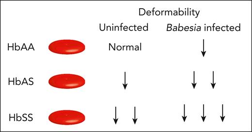 Babesia infection impacts RBC deformability based on hemoglobin status. The degree of deformability can distinguish RBCs isolated from HbAA, HbAS, and HbSS individuals at baseline. Upon Babesia divergens infection, the deformability of RBCs from HbAA, HbAS, and HbSS further declines as indicated.