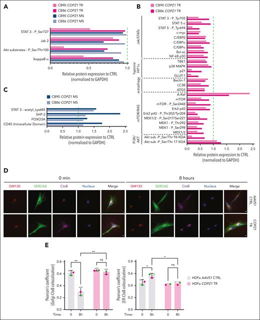 Mutant COPZ1 caused deregulated protein expression, phosphorylation, and retrograde Golgi-to-ER trafficking. (A-C) Protein expression levels in COPZ1 mutant samples relative to their corresponding AAVS1-edited controls, normalized to glyceraldehyde 3-phosphate dehydrogenase (GAPDH) protein loading control levels, as assessed by DigiWest assay. The green dotted line indicates the expression level in COPZ1 WT samples (n = 2). (D) Immunofluorescence images of the CtxB transport assay in AAVS1-edited control and COPZ1-TR adult human primary dermal fibroblasts (HDFa), costained for GM130 (Golgi marker, red), SERCA2 (endoplasmic reticulum calcium pump, green), and nucleus (DAPI, blue). CtxB (cholera toxin subunitB, purple) was analyzed at 2 hours (time 0) and 10 hours (time 8 hours) postexposure to assess intracellular trafficking. The analysis was conducted at 2 hours (time 0) and 10 hours (time 8 hours) after CtxB exposure. Scale bars represent 10 μm. (E) Graphs depict the quantifications of the degree of CtxB colocalization with the Golgi (left) and the ER (right). Data are presented as means ± SD from 3 independent experiments. Statistical significance, ∗P < .05; ∗∗P < .01; ER, endoplasmic reticulum; ns, not significant.