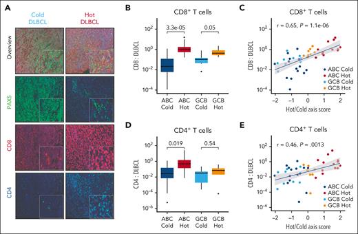 Validation of transcriptionally defined DLBCL-IQs. (A) Representative multispectral immunofluorescence images showing PAX5+ lymphoma cells (green), CD8+ T cells (red), and CD4+ T cells (blue) for a cold (left) and hot (right) DLBCL. (B) Box plot showing average CD8+ T cell to DLBCL cell ratios in immune-related clusters (n = 45). (C) Scatterplot showing correlation of hot/cold axis score (PC1) and CD8+ T cell to DLBCL cell ratio (n = 45). (D) Box plot showing average CD4+ T cell to DLBCL cell ratios in immune-related clusters (n = 45). (E) Scatterplot showing correlation of hot/cold axis score (PC1) and CD4+ T cell to DLBCL cell ratio (n = 45).