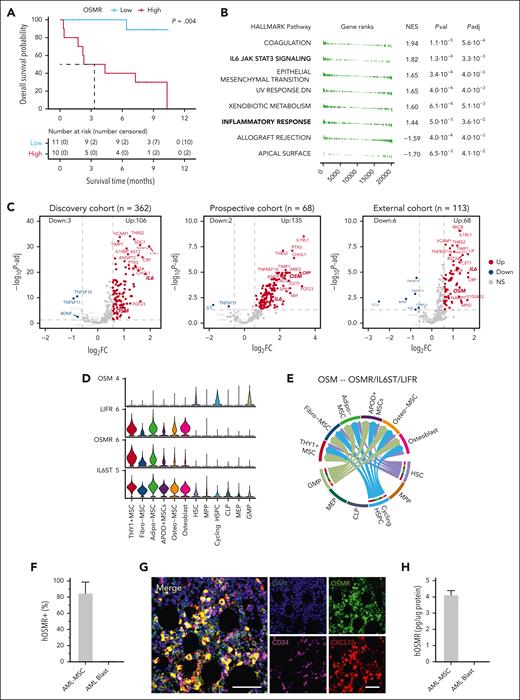 OSMR is secreted by stromal cells in AML. (A) Kaplan-Meier OS curve of OSMR high and low group for patients with both transcriptomic and proteomic profiling (n = 21). (B) Enriched HALLMARK pathways based on ranked gene list. (C) Volcano plot showing differentially expressed proteins between OSMR high and low group in discovery cohort, prospective cohort, and PMCC cohort, respectively. (D) Expression of OSM, LIFR6, OSMR, and IL6ST on subtypes of HSPCs and MSCs in healthy samples. (E) OSM-OSMR/IL6ST/LIFR interaction between subtypes of HSPCs and MSCs. (F) Percent of cells positive for surface OSMR expression by flow cytometry comparing AML blasts and AML MSCs. (G) Multiplex immunofluorescence of AML bone marrow tissue reveals OSMR expression in MSCs, with minimal expression in leukemic cells. This figure depicts an individual cores stained using Opal multiplexed immunohistochemistry showing a representative micrograph of a patient with de novo, treatment-naïve CD34+ AML at diagnosis. OSMR expression (green) is prominent in CXCL12+ MSCs (red) but minimal in CD34+ leukemic cells (magenta). DAPI (4′,6-diamidino-2-phenylindole; blue) serves as a nuclear counterstain. Scale bar, 50 μm. (H) Soluble OSMR concentration from culture of AML blasts vs AML MSCs. Adipo-MSC, adipose-derived MSC; APOD+, apolipoprotein-D positive; CLP, common lymphoid progenitor; FC, fold change; GMP, granulocyte-monocyte progenitor; hOSMR, human OSMR; HSC, hematopoietic stem cell; HSPC, hematopoietic stem and progenitor cell; MEP, megakaryocyte-erythroid progenitor; MPP, multipotent progenitor; NES, normalized enrichment score; NS, not significant; osteo, osteoid; Padj, adjusted P value; Pval, P value.