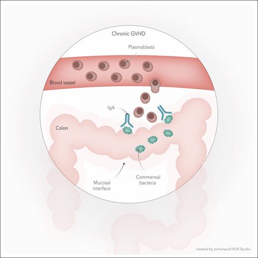 Model for gut microbiota mediation of chronic GVHD. Early posttransplant IgA antibody response to commensal bacteria in the colon leads to clonal expansion of plasmablasts, associated with a higher risk for future cGVHD. The precise mechanism by which the process of bacterial recognition (and possibly immune-mediated clearance), IgA production, and clonal plasmablast expansion may lead to cGVHD is unknown.