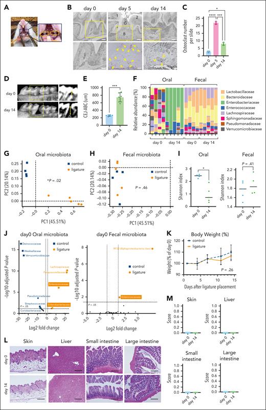Murine OLP leads to local inflammation and oral dysbiosis. (A) OLP using a 5-0 silk suture with 2 knots (∼1 mm apart) located on both sides of the gap between the first and second molars (pointed out with orange dotted ellipse) bilaterally is depicted. (B) Representative tartrate-resistant acid phosphatase (TRAP)–stained sections of gingival tissues harvested at each time point after ligature placement at low (original magnification ×100; scale bar, 100 μm) and high (enlarged yellow frame, original magnification ×400; scale bar, 50 μm) magnifications are shown (1 = the first molar; 2 = the second molar; B = alveolar bone; G = gingival epithelium; arrowheads mark osteoclasts). (C) Total number of osteoclasts per TRAP-stained slide at the ligature site for each time point after ligature insertion. Results represent the mean ± the SD (n = 3 per group, ∗P < .05; ∗∗∗P < .001; and ∗∗∗∗P < .0001 determined using the Mann-Whitney U test). (D) Representative sagittal 3-dimensional and bidimensional (yellow dotted frame) views of the maxillary molars 0 and 14 days after insertion of ligatures are shown. Double-headed yellow arrows mark the distance from the cementoenamel junction to the alveolar bone crest (CEJ-ABC). (E) CEJ-ABC length on the buccal side of the ligature site at each time point after insertion of ligatures is depicted. Bars show the mean ± the SD (n = 6 per group, ∗∗∗P < .001 determined using the Mann-Whitney U test). (F-J) For the isolation of oral bacteria, ligatures were collected from mice 3 hours after ligature placement (day 0) or 14 days after ligature placement (day 14). (F) The relative abundance of microbiota (family level) in the oral cavity and fecal contents at each time point after insertion of ligatures analyzed by 16S rRNA sequencing are shown. (G-H) PCoA by AMOVA of family composition for oral (G) and fecal (H) microbiota from each mouse (n = 4-5 per group). (I) α-Diversity (Shannon index) of oral and fecal microbiota at day 0 and day 14 after OLP is shown (n = 4-5 per group, ∗P < .05 determined using the Mann-Whitney U test). Data are shown as means ± SDs. (J) Volcano plots of differential expression sequencing 2 (DESeq2) analysis showing the amplicon sequence variants identified to the family level features of oral and fecal microbiota that are differentially abundant between the control and OLP groups on day 0 of allo-HCT (n = 4-5 per group). Blue-square (control) and orange-circle (OLP) dots represent bacterial families that significantly differ (log2-fold change of >1, adjusted P value < .05) between each group. The black dots represent families whose abundance is similar between the 2 groups (P value is not significant or the log2-fold change is <1). (K) Body weight change of mice after mock or OLP are shown. Data are presented as the mean ± SD (n = 5 per group). Statistical significance was tested using the Mann-Whitney U test. (L) Representative hematoxylin and eosin–stained histology sections of skin, liver, small intestine, and large intestine at days 0 and 14 after OLP are shown. No significant differences were observed between naïve and OLP mice in any of the tissues examined. Scale bar, 100 μm. (M) Pathological scores of the skin, liver, small intestine, and large intestine at day 0 and day 14 after OLP. The pathology score is based on the diagnostic criteria for cGVHD and reflects the extent of inflammation (day 0 vs day 14, n = 5 per group). Panels B through E and K through M are representative data of 2 independent experiments.