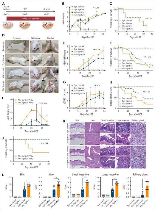 Oral dysbiosis before allo-HCT worsens cGVHD. (A) The experimental procedure for HCT of OLP or control mice is shown. Recipient mice received oral ligatures 14 days before HCT. Spleen T cells and T cell–depleted bone marrow cells from donor mice were injected into irradiated recipients (control and OLP mice, n = 5 per group). Ligatures were kept during the HCT period. Mice were euthanized at day 21 after HCT for analysis. (B-C) The clinical aGVHD score and OS of BALB/c recipients of C57BL/6 donors are shown. The clinical aGVHD score was analyzed using a Wilcoxon matched-pairs signed-rank test, and the data represent the mean ± standard error (SE; control allogeneic mice vs OLP allogeneic mice, n = 5 per group). OS data were analyzed by the log-rank test (control allogeneic mice vs OLP allogeneic mice, n = 5 per group). (D) Representative images of systemic symptoms (ruffled fur and hunched posture), skin damage, and diarrhea of BALB/c recipient mice with or without ligatures at day 21 after HCT using either syngeneic (BALB/c) or allogeneic (B10.D2) donors. The OLP allogeneic recipient mice developed more severe signs of cGVHD than control mice, such as hunch (orange arrow), skin injury, blepharitis, and keratinization (orange arrowheads), and diarrhea (orange cross). (E-F) Representative cGVHD skin score and OS for BALB/c recipients of B10.D2 donor grafts are shown. The cGVHD skin score was analyzed using a Wilcoxon matched-pairs signed-rank test. Data represent the mean ± SE (control allogeneic mice vs OLP allogeneic mice, n = 5 per group). OS data were combined from 6 independent experiments and were analyzed by log-rank test (control allogeneic mice vs OLP allogeneic mice, n = 30 per allogeneic group, n = 18 per syngeneic group). (G-H) Representative cGVHD skin scores and OS of B6D2F1 recipients transplanted with C57BL/6 grafts are depicted. Chronic GVHD skin scores were analyzed using the Wilcoxon matched-pairs signed-rank test and are depicted as means ± SE (control allogeneic mice vs OLP allogeneic mice, n = 5 per group). OS data shown are combined from 4 independent experiments and were analyzed using the log-rank test (control allogeneic mice vs OLP allogeneic mice, n = 20 per allogeneic group, n = 12 per syngeneic group). (I-J) Representative cGVHD skin scores and OS of B6D2F1 recipients transplanted with C57BL/6 grafts using PTCy are depicted. Chronic GVHD skin scores were analyzed using a Wilcoxon matched-pairs signed-rank test with the data shown as means ± SE (n = 5 per group). OS data were analyzed by the log-rank test (n = 5 per group). (K) Representative images of the skin, liver, small intestine, large intestine, and salivary gland stained by hematoxylin and eosin of BALB/c recipients transplanted with B10.D2 grafts at day 21 after HCT. Scale bar, 100 μm. (L) Pathological cGVHD scores of the skin, liver, small intestine, large intestine, and salivary gland at day 21 after HCT. Pathological scores were analyzed by the Mann-Whitney U test and are represented as means ± SD (control allogeneic mice vs OLP allogeneic mice, n = 4-6 per allogeneic group, n = 3 per syngeneic group, ∗P < .05; and ∗∗P < .01). Panels B through E, G, and I through L are representative data of 3 independent experiments. Syn, syngeneic.