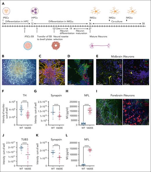 BRAFV600E/WT iMGLs lead to neurodegeneration of iNeurons. (A) Schematic of differentiation of human patient-derived iPSCs into neuronal precursor cells and further forebrain iNeurons is shown, for midbrain iNeurons cells are kept 1 additional week in maturation medium. On day 36 of iMGL differentiation iMGLs were added to iNeurons on day 27 or day 34 of forebrain or midbrain iNeuron differentiation, respectively. Fresh iMGLs were repeatedly added to iNeurons. (B) At day 8 of differentiation neural rosettes are visible. Original magnification: 10×, scale bar: 100 μm. Image was acquired on an Axio Vert.A1 at room temperature. (C) Mature forebrain iNeurons on day 28 after embryoid body formation. Immunofluorescence staining for TUB3 (yellow, Alexa Fluor 488), synapsin (red, Alexa Fluor 568), and DAPI (4′,6-diamidino-2-phenylindole; blue). (D) Mature midbrain iNeurons on day 35 after embryoid body formation. Immunofluorescence staining for nestin (green, Alexa Fluor 488), TH (red, Alexa Fluor 568), and DAPI (blue). (E) Immunofluorescence staining of TH (yellow, Alexa Fluor 568), synapsin (green, Alexa Fluor 488), CD45 (red, Alexa Fluor647), and DAPI (blue): left panel, midbrain iNeurons with WT patient-derived iMGLs; right panel, with mutant patient iMGLs. For panels C-E, pictures were acquired using a Leica SP8 with 40× water objective. (F) Quantification of TH expression in neurite segments of midbrain iNeurons as sum of intensity per well from 5 independent experiments. At least 7 wells per experiment were acquired. (G) Quantification of synapsin expression in midbrain iNeurons as sum of intensity of a well from 3 independent experiments. At least 7 wells per experiment were acquired. (H) Quantification of released NFL in pg/mL from midbrain iNeurons cocultured with either WT or mutated iMGLs from 3 independent experiments. At least 7 wells were analyzed per experiment. NFL was measured using an enzyme-linked immunosorbent assay (ELISA) assay and the supernatants were diluted 1:45. (I) Immunofluorescence staining of coculture of human patient-derived iPSC forebrain iNeurons with iMGLs, synapsin (magenta, Alexa Fluor 568), TUB3 (green, Alexa Fluor 488), CD45 (red, Alexa Fluor 647), and DAPI (blue); left panel, forebrain iNeurons with WT iMGLs; right panel, with mutant iMGLs. (J) Quantification of TUB3 and (K) synapsin expression as sum of intensity of a well in forebrain iNeurons from 3 independent experiments. At least 7 wells per experiment were acquired. (L) Quantification of released NFL in pg/mL from forebrain iNeurons in coculture with BRAFV600E/WT or BRAFWT/WT iMGLs, from 3 independent experiments. At least 7 wells were analyzed per experiment. NFL was measured using an ELISA assay and the supernatants were diluted 1:45. Unpaired parametric Student t test was used with Welch correction when variance was significant between groups, ∗∗∗∗P < .0001. All results presented in this figure were obtained using human patient-derived iPSC iNeurons and iMGLs.