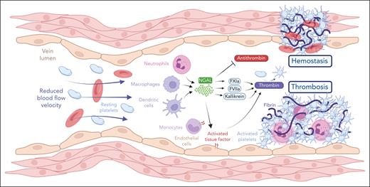 NGAL, usually recognized for its role in inflammation, is now highlighted as a key mediator in thrombosis and hemostasis. In deep vein thrombosis and hemostatic processes, NGAL drives hypercoagulability and promotes clot formation by binding to and enhancing the activities of thrombin, kallikrein, FXIa, and FVIIa while simultaneously inhibiting antithrombin. In addition, NGAL facilitates thrombin-induced platelet aggregation and boosts both the expression and activity of tissue factor on endothelial and monocyte surfaces, thereby initiating and sustaining the clotting cascade. See Figure 6K in the article by Xue et al that begins on page 975. Figure created with BioRender.com.