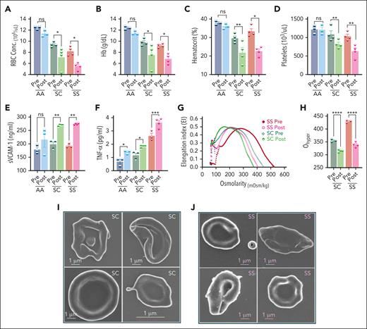 Effects of H/R on hematological features, endothelial activation, inflammation, and HbSC RBC hydration. Mice were exposed to 8% oxygen for 10 hours in a hypoxia chamber, followed by 2 hours of reoxygenation in ambient air. (A) RBC counts (A), Hb concentration (g/dL; B), hematocrit (%; C), platelets (D), sVCAM-1 concentration (ng/mL; E), and Tumor necrosis factor α (TNF-α; picograms per milliliter; F) levels in the plasma, before hypoxia and after H/R. (G) Average osmoscan ektacytometry curves before and after H/R are shown. (H) Ohyper, the osmolarity in the hyperosmolar region at which the RBCs achieve half of their maximal elongation for the data in panel G, is shown. Each symbol in the bar diagrams represents an individual mouse, and the bars represent mean ± standard error of the mean. Statistics were performed using ANOVA. ∗P < .05; ∗∗P < .01; ∗∗∗P < .001; ∗∗∗∗P < .00001. Representative SEM images of RBCs after hypoxia in HbSC (I) and HbSS (J). The specimens were imaged using a Zeiss FE-SEM (Supra 35 VP) at 3 keV with a working distance of 2.9 mm using the Inlens detector. The magnification scale is shown within the micrographs and insets. Conc., concentration; mOsm, milliosmoles; ns, not significant; Post, after H/R; Pre, before hypoxia; sVCAM-1, soluble VCAM-1; TNF-α, tumor necrosis factor α.