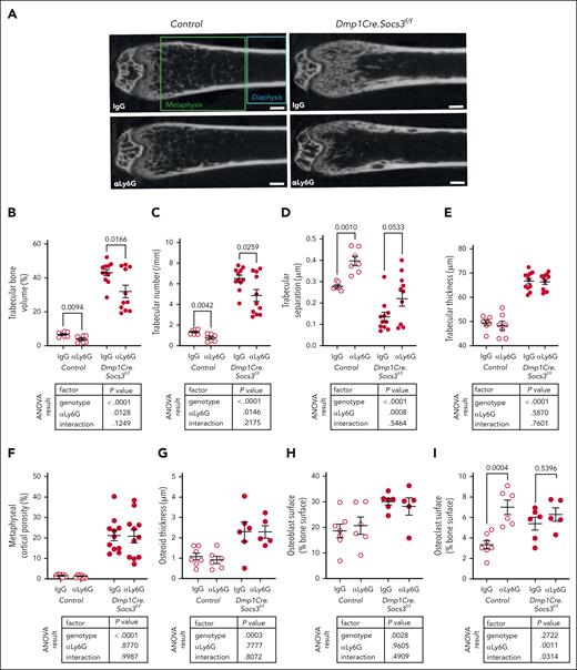 Long-term αLy6G treatment reduced trabecular bone volume in control and Dmp1Cre.Socs3f/f mice by increasing bone resorption. Representative femoral micro-CT images (A) and trabecular bone volume (B), trabecular number (C), trabecular separation (D), trabecular thickness (E), and metaphyseal cortical porosity (F) from control (Socs3f/f) and Dmp1Cre.Socs3f/f mice treated with IgG or αLy6G, as outlined in Figure 4A. Scale bar, 200 μm. (G-I) Histomorphometry of osteoid surface (G), osteoblast surface (H), and osteoclast surface (I) in tibial trabecular bone of control (Socs3f/f) and Dmp1Cre.Socs3f/f mice treated with IgG or αLy6G; histological images are shown in supplemental Figure 1. Data are mean ± SEM, with individual results for each animal shown; results from 2-way ANOVA shown below each graph, including the interaction between both factors (genotype and treatment); numbers above each graph are P values from Šidák post hoc tests for the comparisons shown.