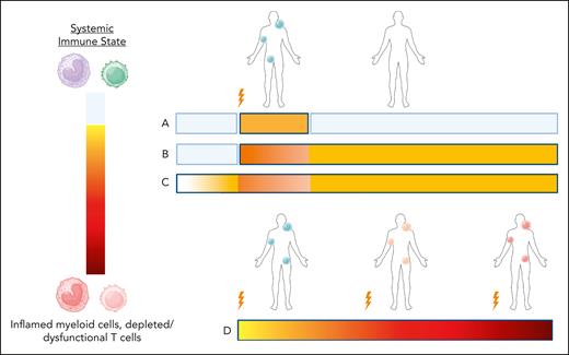 Models of systemic immunity before and after lymphoma diagnosis. Depictions of the systemic immune state in patients who attain durable CR (models A-C) or patients with multiple relapses (model D). The lightning symbol indicates lymphoma diagnosis or relapse. In models A and B, patients have normal systemic immunity until the tumor diagnosis, at which point systemic immune dysregulation is caused by the tumor. Model A, where tumor response results in reversion to normal systemic immunity over time, is not supported by the data of Pelzl et al. In model B, tumor-driven dysregulation of systemic immunity leaves a long-lasting imprint. In model C, systemic immune dysregulation precedes lymphomagenesis, and tumor clearance has minimal effects on this chronic process. Model D depicts progressive worsening of the systemic dysregulation associated with multiple relapses and treatment. Figure created with Biorender.com.