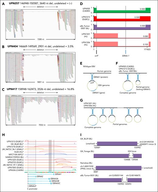 SVs in EBV genomes. (A-C) Representative examples of intragenic deletions. Integrative genomics viewer images display intragenic deletions within EBV genomes from 3 CAEBV patients. Histograms depict read coverage, with individual gray lines representing sequence reads. (A) In patient UPN257, a near-complete deletion is observed, with minimal evidence of retained alleles. (B) In patient UPN404, partial retention of reads within the deleted region suggests the presence of undeleted alleles. Mean read coverage within the deletion (150×) amounts to 3.5% of the genome-wide average (4264×). (C) Patient UPN417 exhibits a different pattern, with mean read coverage within the deletion reaching 16.8% of the genomic average. (D) Partial deletions affecting EBNA1. Five partial deletions targeting EBNA1 were identified, each involving at least half of the EBV genome. All deletions retained the essential replication origin, oriP. (E) Schematic of EBNA1 interaction between viral and host genomes. EBNA1 binds to both the oriP region within the viral genome and a specific site in the host genome. This binding is crucial for viral genome stability, ensuring that viral replication occurs alongside host DNA during cell division. Consequently, every EBV genome copy must possess oriP, and at least 1 functional EBNA1 copy per cell is required for viral persistence. (F) Coexistence of complete and partial genomes. In patients UPN920, UPN1213, and eBL-Tumor-0007, ∼50% of the remaining allele fraction suggests a balanced coexistence of complete and partial EBV genomes within each cell. (G) Predominance of partial genomes. In contrast, patients UPN1301 and UPN1306 exhibited a lower remaining allele fraction (∼10%), indicating a predominance of partial genomes over complete ones. (H) Genomic inversions. Horizontal lines represent individual EBV genomes, with arcs indicating inversions. In total, 12 EBV genomes harbored inversions. The locations of the C promoter and EBNA genes are also illustrated. In the top 6 genomes (marked with asterisks), inversions seem to disrupt the connection between the C promoter and the EBNA genes. (I) Integration into the human genome. Four EBV genomes, all derived from Burkitt lymphoma patients, were found integrated into the human genome. The GK_BL29 EBV genome integrated into intron 3 of the ANKMY1 gene, potentially forming a fusion between RPMS1 within the viral genome and ANKMY1 in the host genome. The GK_Farage EBV genome integrated within the immunoglobulin heavy chain (IGH) locus. The Namalwa EBV genome integrated into intron 4 of the PPIEL gene. Instances where repetitive sequences obscured the precise location of the SV are marked with an asterisk. Last, the eBL-Tumor-0031 EBV genome integrated into chromosome 12q21.31, a region devoid of annotated genes within a 100-kb radius. GC, gastric carcinoma.