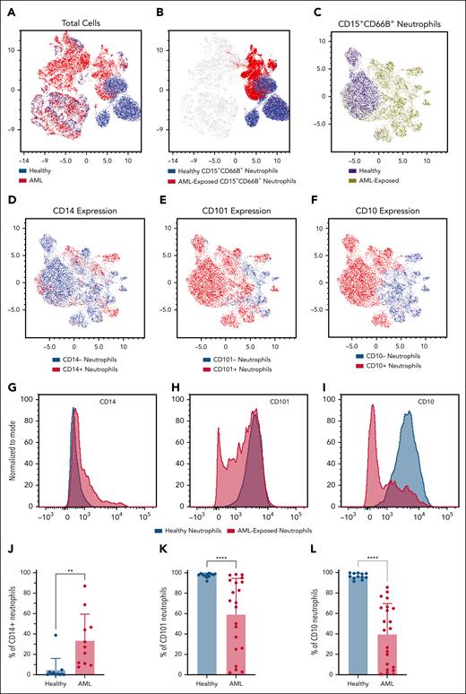 Neutrophils from patients with AML display maturation impairment and express CD14. (A) Bidimensional UMAP analysis of 68 214 CD45+ cells from healthy and AML-diagnosed fresh patient blood samples (n = 17). (B) Expression of CD15+ CD66B+ neutrophils (blue, healthy; red, AML). (C) Five hundred neutrophils from each human sample were projected onto a new bidimensional UMAP. (D) Surface expression of CD14 on neutrophils (blue, healthy; red, AML). (E) Surface expression of CD101 on neutrophils (blue, healthy; red, AML). (F) Surface expression of CD10 on neutrophils (blue, healthy; red, AML). (G,J) Representative histogram and quantification of expression of CD14 in healthy and patient neutrophils (n > 10). (H,K) Representative histogram and quantification of expression of CD101 in healthy and patient neutrophils (n > 10). (I,L) Representative histogram and quantification of CD10 expression in healthy and patient neutrophils (n > 10). Significance is denoted as ∗∗∗∗P ≤ .0001; ∗∗P ≤ .01.