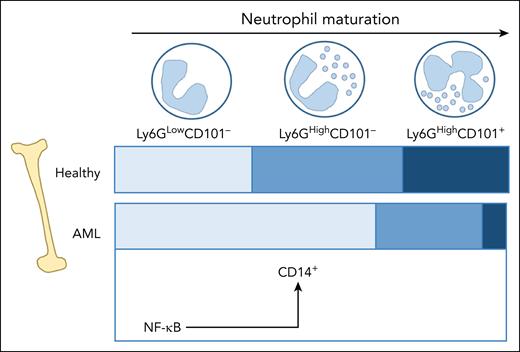 AML disrupts neutrophil homeostatic balance in the BM, resulting in the accumulation of immature subsets aberrantly expressing CD14 on activation of NF-κB.