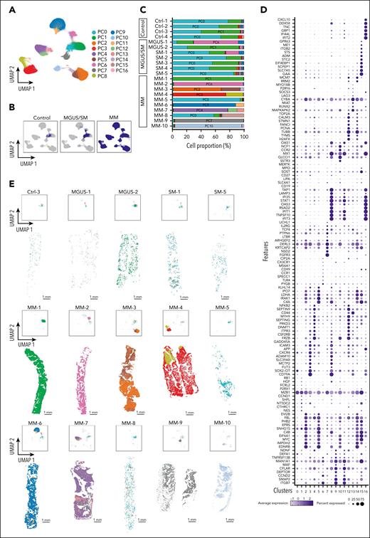 Spatial molecular and cellular map of PCs. (A) UMAP plot of the combined data set of PCs from controls (n = 4), MGUS/SM (n = 7), and MM (n = 10). Colors represent PC clusters. (B) UMAP plot of panel A split into controls, MGUS/SM, and MM data sets. (C) Proportion of PC clusters in each sample. (D) Dot plot showing differentially expressed genes between PC populations in panel A. (E) UMAP and spatial plots for representative control (Ctrl-3), MGUS (MGUS-1 and MGUS-2), SM (SM-1 and SM-5), and all MM (MM-1 to MM-10) samples. Scale bars, 1 mm.