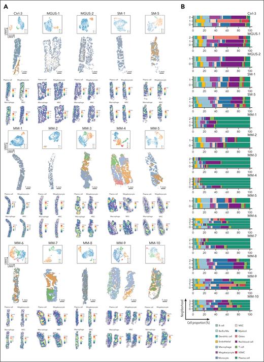 Spatial neighborhood analysis by scider. (A) UMAP and spatial plots of neighborhoods for representative control (Ctrl-3), MGUS (MGUS-1 and MGUS-2), SM (SM-1 and SM-5), and all MM (MM-1 to MM-10) samples. Colors represent transcriptionally distinct neighborhoods. These neighborhoods are deconvoluted with cell labels derived from published scRNA-seq data to generate density heat map for major BM cell types.19 The heat map shows the expected number of cells per hexagonal bin (scale bar, 1 mm). (B) Proportion of annotated cells in distinct neighborhoods for samples in panel A. Ba, basophil; Eo, eosinophil; Ma, mast cell; Osteo, osteo-lineage cells; VSMC, vascular smooth muscle cells.