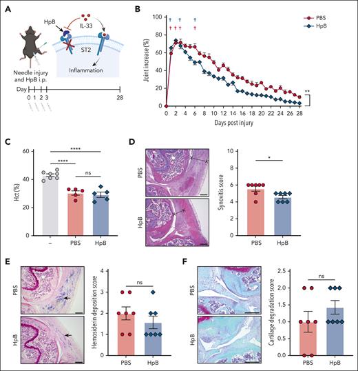 Therapeutic targeting of ST2 ameliorates HA. (A) Graphical illustration of treatment of F8em1−/− mice with HpB to block IL-33 binding to ST2 during needle-induced HA. (B) Increase in the knee joint diameter (percentage) after needle injury of F8em1−/− mice treated with HpB or PBS. Crosses indicate deaths of F8em1−/− mice treated with PBS (red) or HpB (blue). (C) Hct in untreated mice and F8em1−/− mice 3 days after needle injury that were treated with PBS or HpB. (D). Representative hematoxylin and eosin staining of the injured knee joint of F8em1−/− mice treated with HpB or PBS on day 28 after injury, with synovium indicated x----x, and synovitis scores. (E) Images of Prussian blue–stained sections and hemosiderin, indicated by arrow, and deposition scores. (F) Images of safranin O–stained sections and cartilage degradation scores. The scale bar represents 500 μm. Data are from 2 separate experiments and are mean ± SEM from 9 to 12 mice per group. Statistical analysis by ANOVA and the Tukey multiple comparison test or Student t test; ∗P ≤ .05; ∗∗∗P ≤ .001. ns, nonsignificant.