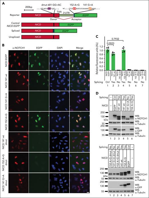 Splicing reporter gene constructs confirm NICD 3′UTR splicing events of noncoding NOTCH1 mutations. (A) Overall structure of the NICD splicing reporter system. The structure on the top reveals the different mutations in NICD 3′UTR together with the cryptic donor (purple) which settles in the coding region of NICD exon 34. The novel splice acceptors (red) generated by nucleotide substitution and the physiological 141 acceptor site (orange) are followed by EGFP complementary DNA (cDNA) sequences. The wt and mutant sequences are shown at the top. Only on alternative 3′UTR splicing does EGFP get spliced in frame with NICD (third panel, spliced). Thus, a NICD::EGFP fusion protein is translated and translocated to the nucleus, leading to GFP+ nuclei. In the case of unspliced events (lower panel, unspliced), translation of NICD is terminated by the normal stop codon (TAA) resulting in NICD+ but GFP–nuclei. NICD EGFP represents an NICD::EGFP cDNA fusion construct acting as a positive Ctrl. (B) Images of immunofluorescence signals of NICD 3′UTR splicing reporter system in HeLa wt cells. NICD+ nuclei from different constructs demonstrated equal transfection efficiencies. GFP+ signals in the nuclei demonstrated 3′UTR splicing. After merging images of NICD+ and GFP+ signals with DAPI-stained HeLa wt nuclei, different splicing efficiencies of NOTCH1 noncoding mutations were displayed. Scale bar, 20 μm. (C) Quantification of immunofluorescence signals of NICD 3′UTR splicing reporter system in HeLa wt cells by ImageJ. Relative fluorescence units were normalized to signals of positive Ctrl (NICD EGFP). n = 6; mean ± standard deviation (SD); 2-tailed unpaired t test; P values are shown. (D) WBs using lysates from HEK 293 wt overexpressing NICD 3′UTR splicing reporter constructs repeated the same splicing processes and efficiencies as immunofluorescence in HeLa wt. − represents untransfected samples. Ctrl, control; DAPI, 4′,6-diamidino-2-phenylindole; dmut, donor mutated; WB, western blot.