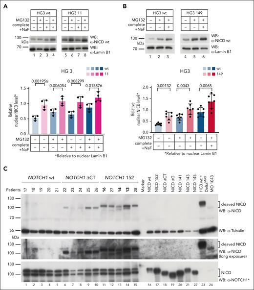 Nuclear NICD wt is stabilized in HG3 (NICDwt/152) cells and samples from patients with CLL with heterozygote 152 mutations.NOTCH1 152 A>G mutation in HG3 11 (A) and HG3 149 (B) was introduced by CRISPR/Cas9 (see supplemental Figure 9). After nuclear extraction, significantly higher intensities of endogenous nuclear NICD wt were detected by WB and the following quantification compared with HG3 wt. − indicates the absence of corresponding chemicals, and + denotes the presence of respective chemicals. Quantifications were performed by ImageJ. Mean ± SD; n = 4 in panel A and n = 7 in panel B; 2-tailed unpaired t test. Blots are representative of at least 3 blots. (C) Analyzing NICD signals from lysates of NOTCH1 wt (lanes 1-5), coding NOTCH1 ΔCT mutated (lanes 6-10) and NOTCH1 152 mutated (lanes 11-15) patients with CLL. Stabilization of truncated NICD (ΔCT patients) and even more evident NICD wt from NOTCH1 152 mutated patients can clearly be detected. Lysates from transfected NICD proteins, missing the amino-terminal valine 1754 residue and expressed in NOTCH1 KO HEK 29324 cells, served as a negative control (lanes 16-22). Lysates from DeltaMax stimulated HG3 cells29 (lane 23) and MO1043 cells expressing a truncated NICD served as positive controls for the antibody. A longer exposure blot is shown (middle). The α-NOTCH1∗ antibody (bottom) was used as a general NOTCH1 expression control.