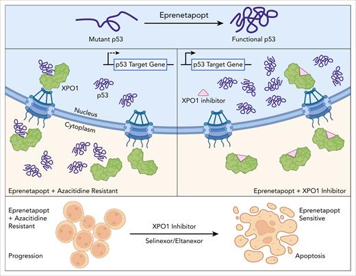 The findings presented by Kruer et al suggest a mechanism whereby, in the context of AZA-dependent XPO1 overexpression, the functional activity of p53 and transcription of its key downstream genes that have been restored by eprenetapopt are abolished via XPO1 (exportin-1)-mediated transport out of the nucleus, thus conferring resistance to the combination therapy. Treatment with XPO1 inhibitor is a proposed therapeutic approach for restoring nuclear p53 activity in combination with eprenetapopt. Figure created with BioRender.com. D’Andrea R. (2025) https://BioRender.com/te49jr2.