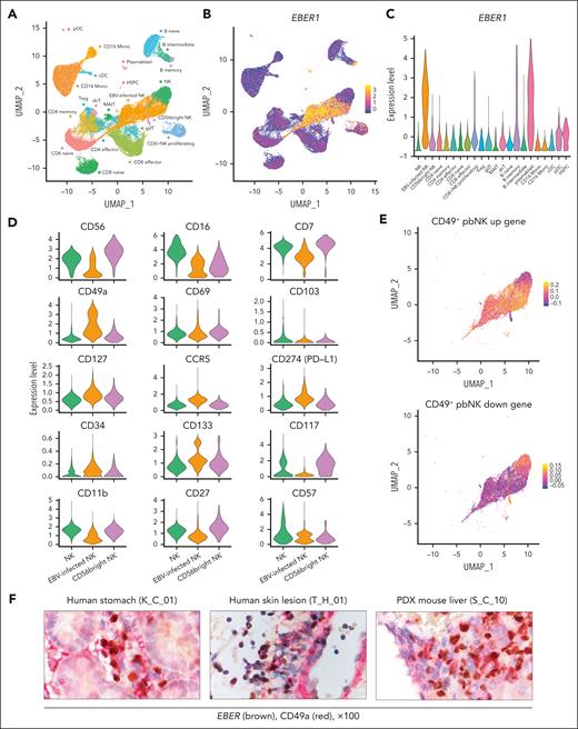 Enrichment of tissue-resident signatures in EBV-infected NK cells. (A) UMAP embedding of scRNA-seq data for 49 878 cells from PBMCs of 3 patients with CIMP-positive CAEBV, 3 patients with CIMP-negative CAEBV, 2 patients with IM, and 2 healthy volunteers. Twenty-two cell types were defined according to the RNA expression of marker genes (supplemental Figure 8A). (B) UMAP plot colored according to EBER1 expression level. (C) Violin plot showing the expression of EBER1 in each cell type. (D) The expression of NK-lineage-defining surface markers is displayed using violin plots in 3 NK clusters (NK, EBV-infected NK, and CD56bright NK). (E) UMAP embedding of NK cells colored by CD49+ peripheral blood NK (CD49+ pbNK) up (upper) and down (lower) gene score. The score was calculated using a published gene list (supplemental Table 12). (F) Representative images of dual immunostaining for EBER (brown) and CD49a (red) in a human stomach biopsy sample (K_C_01, left), a skin lesion biopsy sample (T_H_01, middle), and a liver sample from a PDX mouse engrafted with NK-LCLs (S_C_10, right). cDC, conventional dendritic cell; dnT, double negative T; gdT, γδ T; HSPC, hematopoietic stem and progenitor cell; MAIT, mucosal associated invariant T; pDC, plasmacytoid dendritic cell; PD-L1, programmed cell death 1 ligand 1; PDX, patient-derived xenograft; Treg, regulatory T.