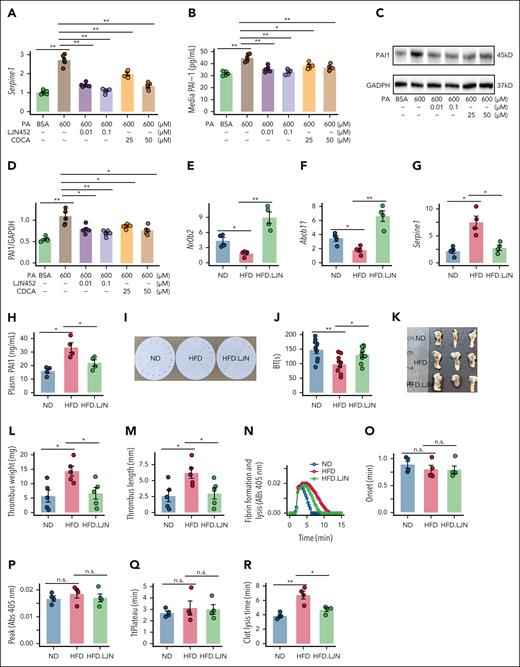 FXR agonists improve obesity-induced fibrinolysis impairment and high DVT burden. (A-H) MPHs were treated with palmitic acid for 6 hours and subsequently coincubated with FXR agonists (CDCA and tropifexor) for the next 6 hours: (A) Serpine1 mRNA (N = 5); (B) PAI-1 concentration in medium (N = 5); (C-D) PAI-1 protein (N = 5). (E-R) Obese mice treated with tropifexor were randomly selected for DVT modeling or other assays (N = 4): (E) liver Nr0b2 mRNA (N = 4); (F) liver Abcb11 mRNA (N = 4); (G) liver Serpine1 mRNA (N = 4); (H) plasma PAI-1 levels (N = 4); (I-J) tail bleeding time (N = 9); (K-M) thrombus weight and length (N = 5); (N-R) representative curves for plasma fibrin formation and lysis tests and parameters of the curves for fibrinolysis (N = 4). The data are represented as the mean ± SEM, n.s. P > .05; ∗P < .05; ∗∗P < .01 vs PA600 or HFD group. BSA, bovine serum albumin; BT, bleeding time; GAPDH, glyceraldehyde-3-phosphate dehydrogenase; LJN452, tropifexor; n.s., no significance; PA, palmitic acid.