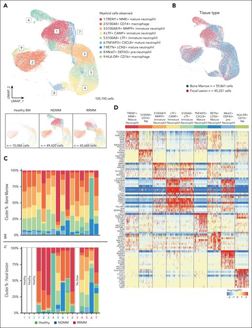 CD11b+ myeloid cells from BM and FLs from patients with MM, and HBM. (A) Samples from patients with NDMM (n = 6), RRMM (n = 7) (BM and FLs), and from HBM (n = 3) are shown in the UMAP representation of 105 192 CD11b+ cells captured with 10× V3 5ʹ scRNA-seq (see “Materials and methods” for complete details). Nine clusters observed were: (1) TREM+MME+ mature neutrophils, (2) S100A8+CD14+ macrophages (Mϕ), (3) S100A8/9+MMP9+ immature neutrophils, (4) LTF+CAMP+ immature neutrophils, (5) S100A8+LTF+ immature neutrophils, (6) TNFAIP3+CXCL8+ mature neutrophils, (7) RETN+LCN2+ mature neutrophils, (8) Mki67+DEFA3+ preneutrophils, and (9) HLA-DR+CD16+ macrophages. Bottom panels represent cell contributions from HBM (left), NDMM (middle), and RRMM (right). (B) UMAP representation of CD11b+ cells observed. The contribution of BM-derived cells (n = 59 861 cells) is shown in blue. The contribution of FL-derived cells (n = 45 331 cells) is shown in red. (C) Scaled bar graph representation of each cell type contribution (y-axis) from healthy donors and patients with MM (x-axis; n = 16). Color convention as per panel A. Top panel, cell type distribution from BM cells; bottom panel, cell type distribution from FLs (1 sample without cells). (D) Scaled normalized heat map of top 10 transcripts associated with each cluster. Sample downsized to 5000 cells per cluster. Blue represents downregulated genes, and red represents upregulated (log2 fold-change) genes in cell types shown at top.