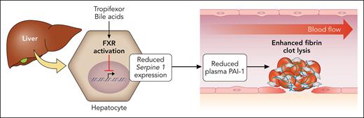 Activation of FXR in hepatocytes by bile acids or tropifexor downregulates expression of Serpine 1, the gene that encodes PAI-1. This results in decreased plasma levels of PAI-1 and enhancement of fibrin-clot lysis. Professional illustration by Patrick Lane, ScEYEnce Studios.