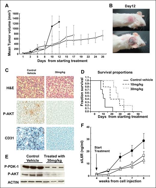 In vivo efficacy of IC488743 treatment of human MM xenografts in SCID mice. (A) Mice injected with 5 × 106 LB cells were treated orally twice a day with control vehicle (●), and IC488743 10 mg/kg ( □ ) or 30 mg/kg (○). Mean tumor volume was calculated as in “Murine xenograft models of human MM.” Error bars represent SD. (B) Representative whole-body images from a mouse treated for 12 days with control vehicle (top panel) or IC488743 (30 mg/kg; bottom panel). (C) Tumors harvested from IC488743 (30 mg/kg) treated mouse (right panel) and control mouse (left panel) were subjected to immunohistochemical analysis using CD31 and P-AKT Abs. CD31 and P-AKT positive cells are dark brown. (D) Mice were treated with IC488743 10 mg/kg (hyphenated line), 30 mg/kg (dotted line), or control vehicle (solid line). Survival was evaluated from the first day of treatment until death using Kaplan-Meier curves. (E) Tumor tissues were harvested from mice treated with control vehicle or IC488743 (30 mg/kg). Protein levels of phosphorylated of PDK-1 and AKT (Ser473) were determined by Western blotting of cell lysates. Actin was used as a loading control. (F) Growth of INA-6 cells engrafted in human bone chips in SCID mice was monitored by serial serum measurements of shuIL-6R. Mice were treated with IC488743 10 mg/kg ( □ ), 30 mg/kg ( △ ), or control vehicle (●), and shuIL-6R levels were determined weekly by ELISA. Error bars represent SD.