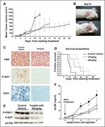 In vivo efficacy of IC488743 treatment of human MM xenografts in SCID mice. (A) Mice injected with 5 × 106 LB cells were treated orally twice a day with control vehicle (●), and IC488743 10 mg/kg ( □ ) or 30 mg/kg (○). Mean tumor volume was calculated as in “Murine xenograft models of human MM.” Error bars represent SD. (B) Representative whole-body images from a mouse treated for 12 days with control vehicle (top panel) or IC488743 (30 mg/kg; bottom panel). (C) Tumors harvested from IC488743 (30 mg/kg) treated mouse (right panel) and control mouse (left panel) were subjected to immunohistochemical analysis using CD31 and P-AKT Abs. CD31 and P-AKT positive cells are dark brown. (D) Mice were treated with IC488743 10 mg/kg (hyphenated line), 30 mg/kg (dotted line), or control vehicle (solid line). Survival was evaluated from the first day of treatment until death using Kaplan-Meier curves. (E) Tumor tissues were harvested from mice treated with control vehicle or IC488743 (30 mg/kg). Protein levels of phosphorylated of PDK-1 and AKT (Ser473) were determined by Western blotting of cell lysates. Actin was used as a loading control. (F) Growth of INA-6 cells engrafted in human bone chips in SCID mice was monitored by serial serum measurements of shuIL-6R. Mice were treated with IC488743 10 mg/kg ( □ ), 30 mg/kg ( △ ), or control vehicle (●), and shuIL-6R levels were determined weekly by ELISA. Error bars represent SD.