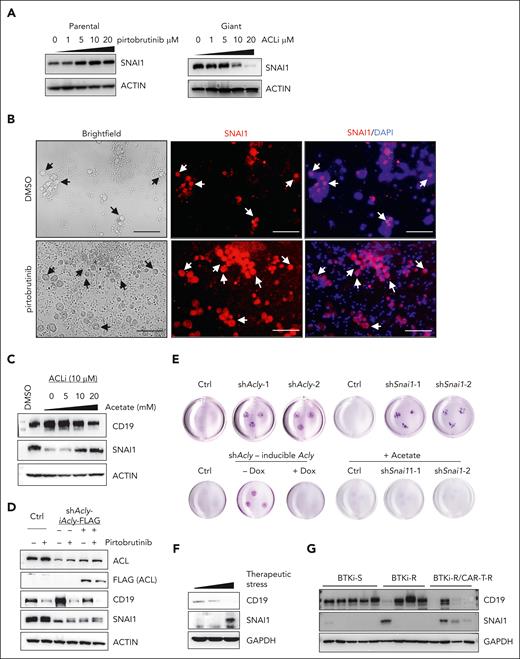 Stabilized SNAI1 through acetylation determines the fate of giant cells. (A) Western blots showing the protein levels of SNAI1 in response to PBN treatment for 72 hours and ACLi for 48 hours. (B) Immunofluorescence assay showing the presence of giant cells are indicated by selectively increased levels of SNAI1 in a PDO sample (PT6) treated with or without PBN ex vivo. Arrows indicate the presence of giant cells. Blue, DAPI; red, SNAI1 (Texas red). Scale bar, 100 μm. (C) Western blots of CD19 and SNAI1 in giant cells treated with ACLi and supplemented acetate (48 hours). (D) Western blots showing Dox-inducible expression of FLAG-tagged ACL in Acly-knockdown cells (Dox, 1 μg/mL for 72 hours). (E) Representative spheroid 3D culture (2 weeks) of Acly- or Snai1-knockdown giant cells and Acly-knockdown giant cells with or without Dox-inducible ACL expression. Acetate, 20 mM. (F) Western blots of SNAI1 and CD19 levels in tumors from patients with MCL with increased therapeutic stress. (G) Western blots of SNAI1 and CD19 levels in tumors from patients with MCL sensitive to BTKis (BTKi-S), resistant to BTKis (BTKi-R), and resistant to BTKi and CAR T-cell therapy (BTKi-R/CAR-T-R). Ctrl, control; Dox, doxycycline; GAPDH, glyceraldehyde-3-phosphate dehydrogenase.