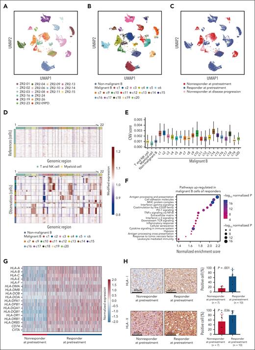Intertumoral heterogeneity of DLBCL associated with the efficacy of ZR2. (A) UMAP of malignant and nonmalignant B cells, with each cell colored for sample origin. (B) UMAP of malignant and nonmalignant B cells, with each cell colored for malignant and normal clusters. (C) UMAP of malignant and nonmalignant B cells, with each cell colored for sample subgroups according to efficacy and time point. Samples of responders (n = 12) and nonresponders (n = 5) were collected before treatment, with 1 paired sample collected from one of the nonresponders at disease progression. (D) The inferred single-cell CNVs are shown with single cells (rows) and chromosomal regions (columns) for each malignant cluster and reference immune cells. (E) The inferred CNV scores are shown for each malignant cluster and reference immune cells. (F) Upregulated pathways in malignant B cells of responders (n = 12) by gene set enrichment analysis compared with nonresponders (n = 5). Color and size of points indicate normalized P value of upregulated pathways in the 2 groups, respectively. (G) Heat map of differentially expressed genes in malignant B cells between responders (n = 12) and nonresponders (n = 5). The 2-sided P values were calculated using the Wilcoxon rank sum test. (H) Immunohistochemical assay of HLA-I and HLA-II in tumor samples of responders (n = 10) and nonresponders (n = 7). The 2-sided P values were calculated using the Student t test. CNV, copy number variation; NK, natural killer cell; UMAP, Uniform Manifold Approximation and Projection.