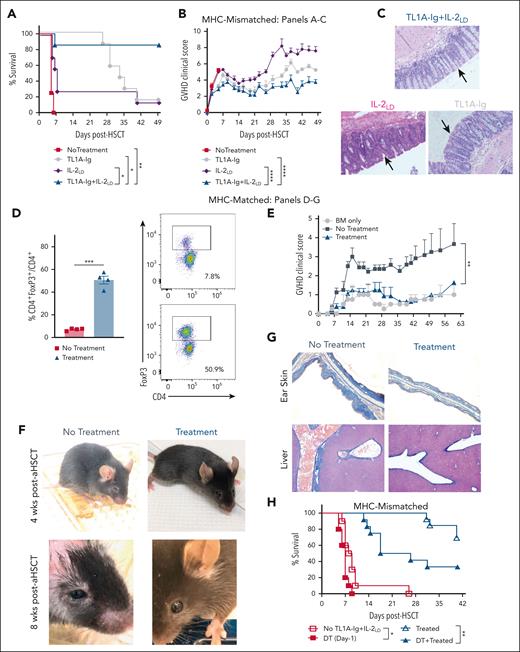 Combinatorial vs individual TL1A-Ig and IL-2 treatment before major and minor MHC-mismatched aHSCT. (A-C) Evaluation of recipients after individual TNFRSF25 or high-affinity IL-2 receptor stimulation compared with combined stimulation before conditioning and aHSCT. Mice were administered TL1A-Ig only, IL-2LD only, or TL1A-Ig+IL-2LD (see supplemental Figure 4A for details). aHSCT was performed using a B6→BALB/c donor/recipient mouse model. B6-FoxP3RFP (H2b) TCD BM (5.5 × 106) cells and an adjusted spleen cell number containing 6.5 × 105 T cells were transplanted into BALB/c (H2d) recipients after TBI conditioning (7.75 Gy) on day-1. (A) Overall survival (n = 7), (B) GVHD clinical score (n = 7), and (C) representative colon histological images of tissue harvested at day +56. Arrows indicate differences in villi structure, more normal appearance in TL1A-Ig+IL-2LD vs monotherapy. Combinatorial pretreatment resulted in the best outcomes, with fewer lymphocytic infiltrates in the colonic tissue. (D-G) The combinatorial treatment was examined in a second (low lethality) aHSCT model. MHC-matched, minor antigen–mismatched C3H.SW (H2b) TCD BM (7 × 106) cells and 2 × 106 CD8+ T cells were transplanted into B6 (H2b) recipients after TBI conditioning (10.5 Gy) on day 0. (D) At day −2, assessing Treg frequencies showed significant CD4+FoxP3+/CD4+ expansion with pretreatment. (E) GVHD clinical scores were less severe in pretreated recipients (n = 4-8). (F) Representative images of mice show appearances at 4 and 8 weeks after aHSCT. Pretreated recipients exhibited less skin and ocular GVHD involvement. (G) Collagen deposition (Masson trichrome stain, blue) in the skin of mice 8 weeks after aHSCT. In treated recipients, note the thin epidermis, scant dermis collagen staining, and the absence of inflammatory cells compared with untreated recipients exhibiting a thickened epidermis, extensive collagen deposition in the dermis, and a modest infiltration of chronic inflammatory cells (original magnification ×10). Heightened collagen and hepatic periportal infiltrates were detected in untreated MHC-matched recipients. (H) Treg depletion immediately before transplant reduces but does not abolish GVHD. BALB/c DT receptor mice were untreated or pretreated with TL1A-Ig+IL-2LD before transplant with B6 TCD BM spleen cells. DT (1 μg IP) was administered on day −1 before TBI. Depleting resident Tregs reduced overall survival in pretreated as well as in untreated recipients (n = 5-7). Wks, weeks.