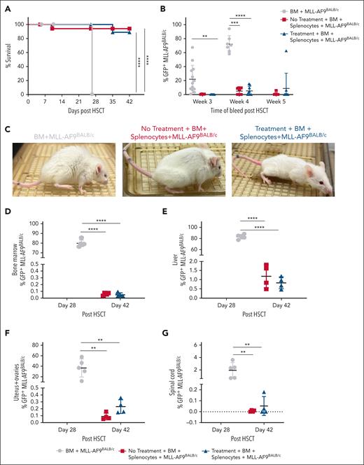 Recipient mice pretreated with TL1A-Ig+IL-2LD before aHSCT enable GVL responses concomitant with GVHD amelioration. B6 (donor) → BALB/c (recipient) aHSCT with and without recipient TL1A-Ig+IL-2LD pretreatment was performed. All groups received 5 × 103 BALB/c-MLL-AF9GFP cells (IV) at the time of aHSCT, (n = 9-13 mice per group). (A) Overall survival. No animals survived in the BM-only group vs >85% for the (BM + T cells) and (BM + T cells with recipient treatment) groups (n = 5). (B) BALB/c-MLL-AF9GFP cell frequency in the PB at 3, 4, and 5 weeks after aHSCT. Treg expansion in the recipient group enabled a GVL response against BALB/c-MLL-AF9GFP cells that was as effective as the response in untreated recipients (BM + T cells) denoted by minimal detection of GFP expression. (C) Representative photographs of mice from each group at 4 weeks after aHSCT. (D-G) BALB/c-MLL-AF9GFP frequency in hematopoietic compartments, that is, the BM (D); and nonhematopoietic compartments, that is, the liver (E), uterus and ovaries (F), and spinal cord (G), at days 28 and 42 after aHSCT.