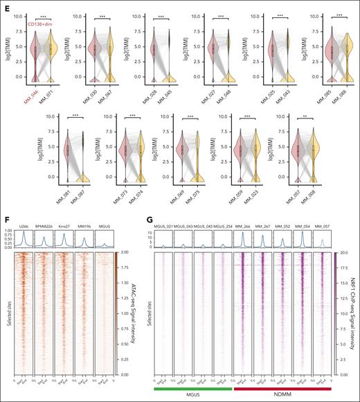 NRF1 binding sites contribute to multiple myeloma pathogenesis. (A) Schematic representation of the workflow followed in the building of the MM-specific master list of NRF1-binding sites by combining consensus NRF1 binding peaks with MGUS-specific accessible regions. (B) UpSet plot depicting the overlap of NRF1-binding sites across varied MM cell lines (Kms18, MM196, MM217, and Kms27). The bar plot above represents the number of common peaks in each intersection group, with the total number of peaks in each cell line shown in the horizontal bar chart (left). The highlighted bar indicates the intersection of consensus peaks shared by all 4 cell lines (n = 5749). (C) A Venn diagram showing the number of MM-specific NRF1 binding peaks emerged by intersecting the cumulative MGUS ATAC-seq peaks (blue) with the MM NRF1-binding sites (red). (D) Unsupervised clustering heat map showing normalized scaled accessibility counts (z score of CPM) of NRF1 MM-specific binding sites (n = 699, left bar in blue) and randomly selected NRF1-binding sites common between MM and MGUS samples (n = 300, light blue). Top bar annotations represent the disease type (MM, purple; MGUS, green), MM disease status (NDMM, orange; treated, light purple), and the percentage of malignant PCs (red-to-white gradient, 100%-0%). Accessibility data come from ATAC-seq of MM (n = 55) and MGUS (n = 11) samples. Each column corresponds to a patient sample, and the entire cohort was clustered using the Ward D method with Euclidean distance to assess similarity. (E) Violin plots comparing chromatin accessibility at NRF1 MM-specific binding sites in matched NDMM and treated samples (n = 11), based on ATAC-seq data. Each panel represents a matched pair of samples, with corresponding Wilcoxon P values indicating significant differences in chromatin accessibility of selected sites (∗∗P < .01; ∗∗∗P < .005). The y-axis of each panel shows the log-transformed CPM of ATAC-seq signal intensity. Sample MM_046 is highlighted for its peculiarity in being CD138+dim (low). (F) Heat maps (bottom) and aggregate profiles (top) showing ATAC-seq signal intensity at NRF1 MM-specific binding sites across MM cell lines (U266, RPMI8266, Kms27, and MM196) and merged MGUS (n = 11) samples. The aggregate profiles display signal intensity from 0 (weak) to 1 (strong), whereas the heat maps use a dark red to white gradient to indicate high to low accessibility. (G) Heat maps (bottom) and aggregate profiles (top) displaying ChIP-seq signal intensity at NRF1 MM-specific binding sites across NDMM (n = 5) and MGUS (n = 4) samples. The aggregate profiles display signal intensity from 1 (weak) to 15 (strong), whereas the heat maps use a dark purple to white gradient to indicate high to low NRF1 occupancy. CPM, counts per million; TMM, trimmed mean of M-values.